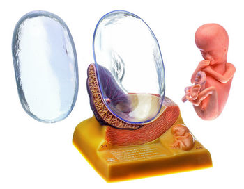 MS 11/3 Menschlicher Embryo im 3. Monat