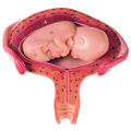 MS 12/4 Uterus mit Fetus im 4. bis 5. Monat